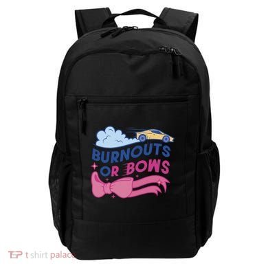 Burnouts Or Bows Gender Reveal Backpack