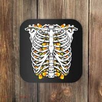 Candy Corn Skeleton Hallween Costume Coaster thumb 0