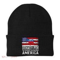 Donkey Pox Funny Anti Democrat Beanie thumb 0