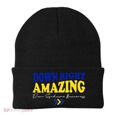 Down Right Amazing Down Syndrome Awareness Beanie