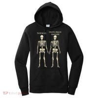 Ehlers Danlos Syndrome Skeletons Zebra Awareness Women's Hoodie thumb 0