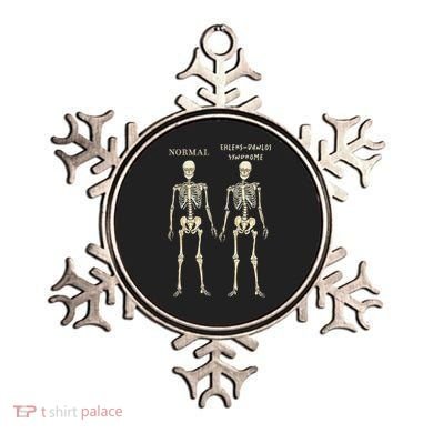 Ehlers Danlos Syndrome Skeletons Zebra Awareness Ornament