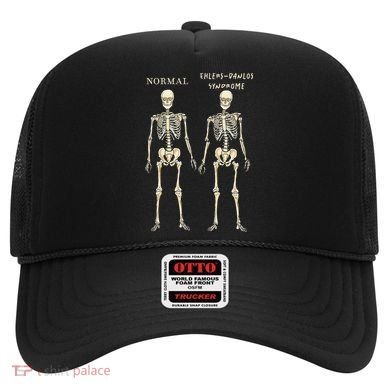 Ehlers Danlos Syndrome Skeletons Zebra Awareness Hat