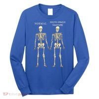Ehlers Danlos Syndrome Skeletons Zebra Awareness Long Sleeve Shirt thumb 0
