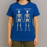 Ehlers Danlos Syndrome Skeletons Zebra Awareness T-Shirt thumb 4