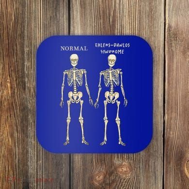 Ehlers Danlos Syndrome Skeletons Zebra Awareness Coaster