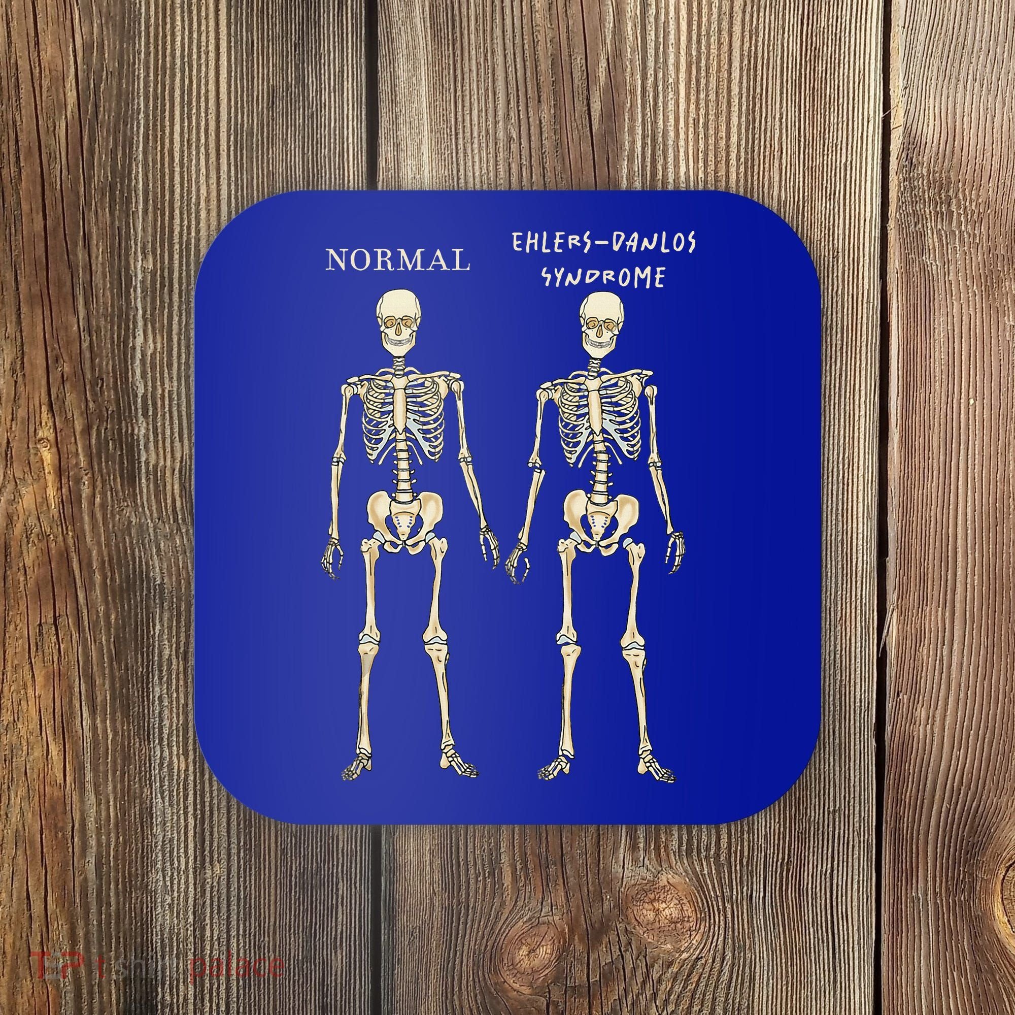 Ehlers Danlos Syndrome Skeletons Zebra Awareness Coaster