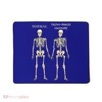 Ehlers Danlos Syndrome Skeletons Zebra Awareness Mousepad thumb 0