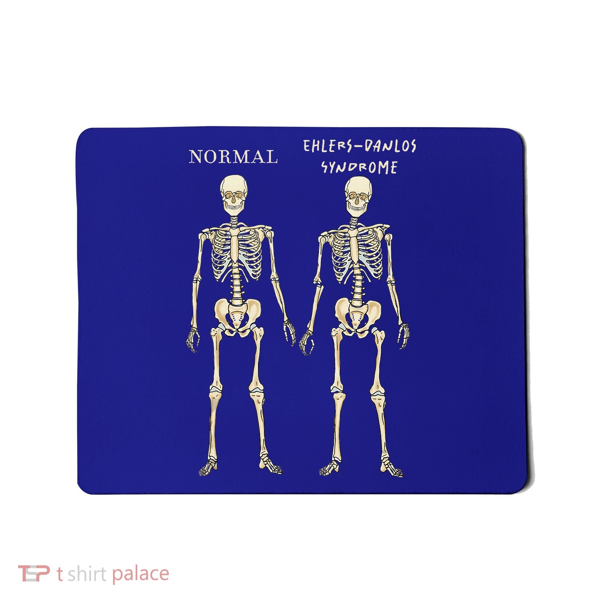 Ehlers Danlos Syndrome Skeletons Zebra Awareness Mousepad