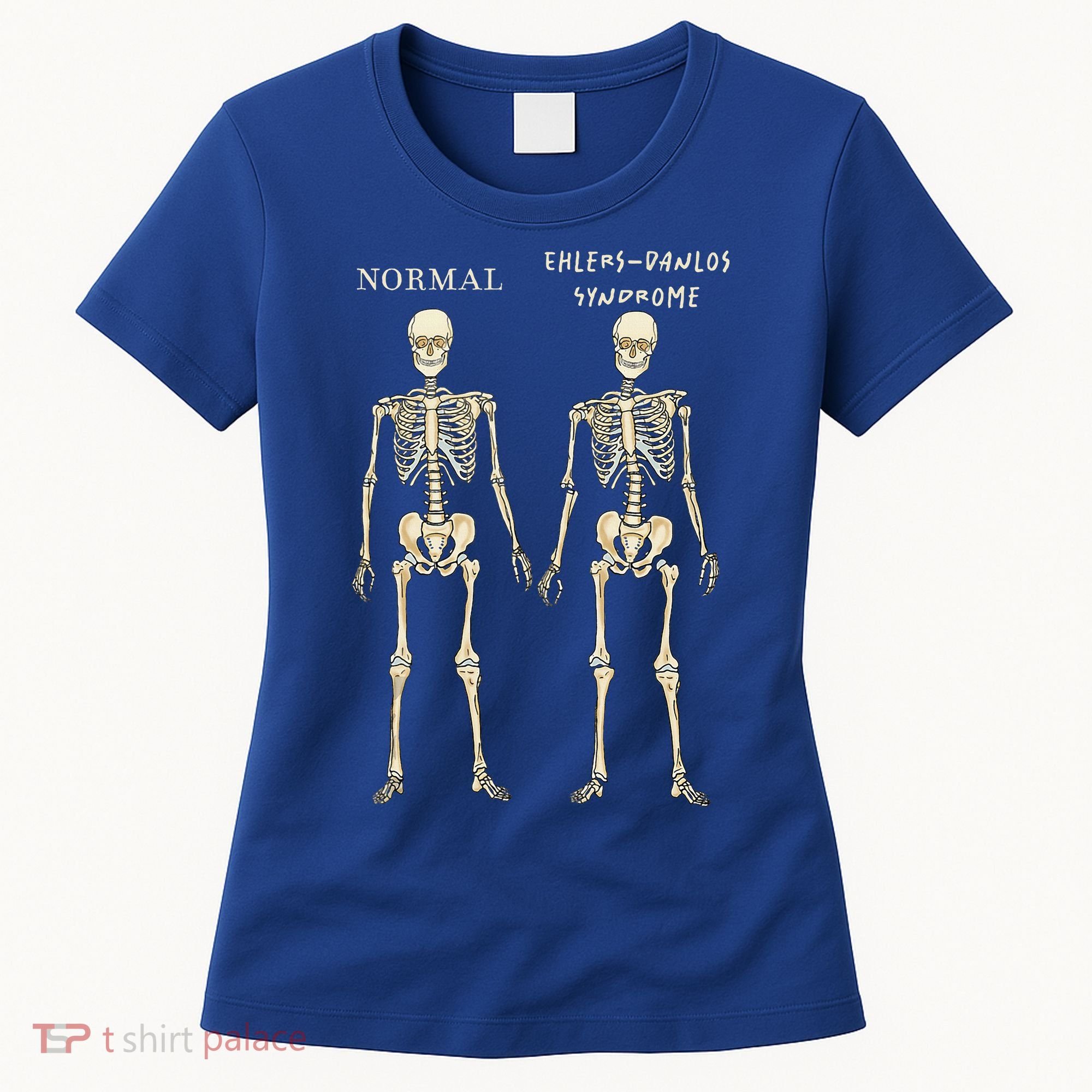 Ehlers Danlos Syndrome Skeletons Zebra Awareness Women's T-Shirt