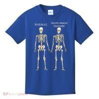 Ehlers Danlos Syndrome Skeletons Zebra Awareness Kids T-Shirt thumb 0