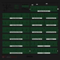 EKG Training Mug Tote Bag thumb 4