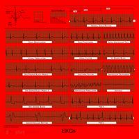 EKG Training Mug Santa Hat thumb 1