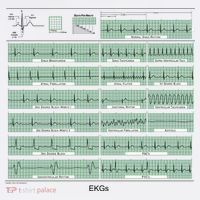 EKG Training Mug Women's Hoodie thumb 2