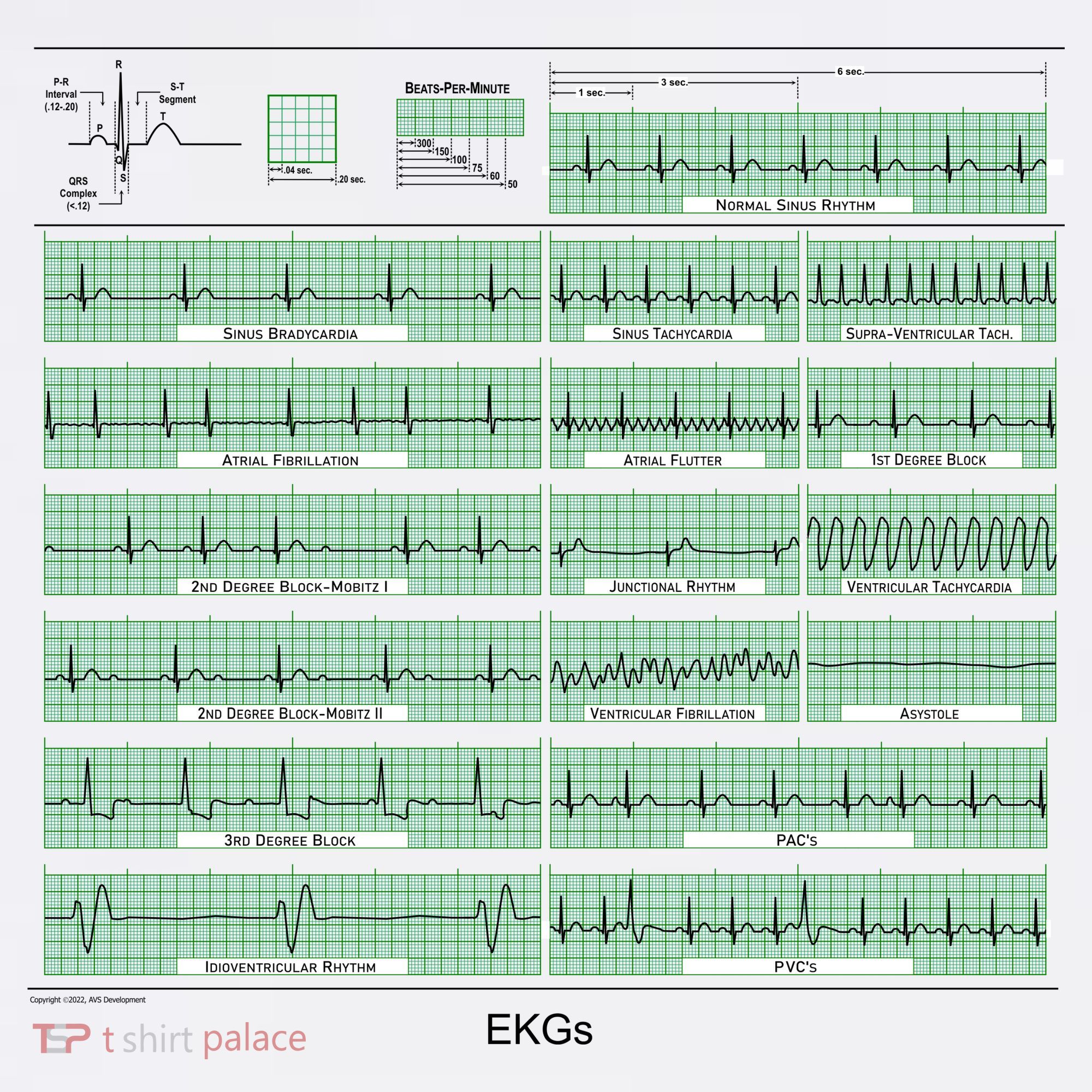EKG Training Mug Women's T-Shirt