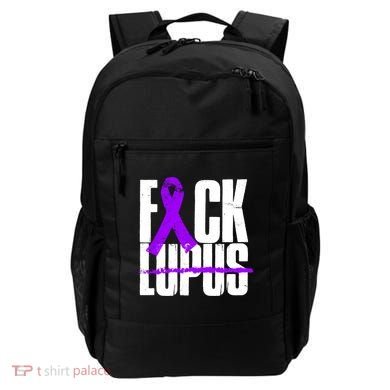 F*ck Lupus Backpack