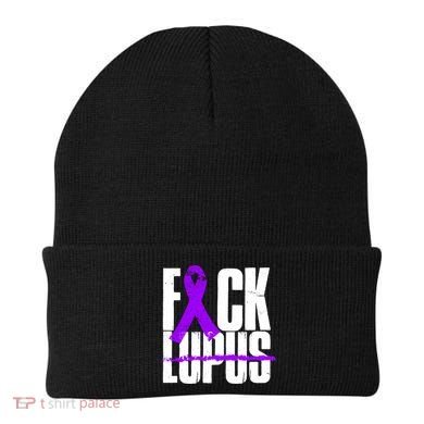 F*ck Lupus Beanie