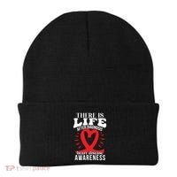 Heart Disease Awareness Month Red Ribbon Chd Gift Beanie thumb 0