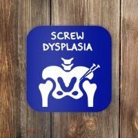 Hip Dysplasia Gift Screw Dysplasia Awareness Funny Gift Coaster thumb 0