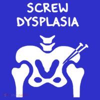 Hip Dysplasia Gift Screw Dysplasia Awareness Funny Gift Women's Tank Top thumb 5