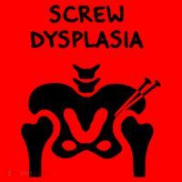 Hip Dysplasia Gift Screw Dysplasia Awareness Funny Gift Santa Hat thumb 1
