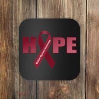 Hope For Multiple Myeloma Awareness Tribute Coaster thumb 0