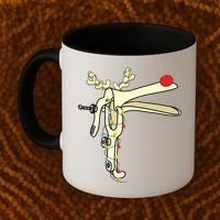 Obgyn Nurse Merry Christmas Reindeer Speculum Xmas Lights Coffee Mug thumb 2