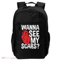 Pre Heart Transplant And After Open Heart Surgery Cool Gift Backpack thumb 0