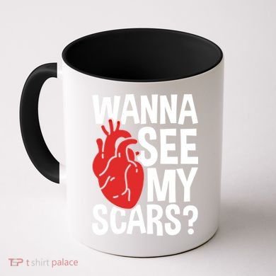 Pre Heart Transplant And After Open Heart Surgery Cool Gift Coffee Mug