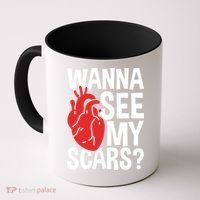 Pre Heart Transplant And After Open Heart Surgery Cool Gift Coffee Mug thumb 0