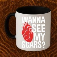Pre Heart Transplant And After Open Heart Surgery Cool Gift Coffee Mug thumb 2