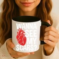 Pre Heart Transplant And After Open Heart Surgery Cool Gift Coffee Mug thumb 3