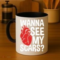 Pre Heart Transplant And After Open Heart Surgery Cool Gift Coffee Mug thumb 4
