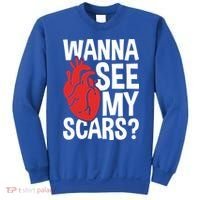 Pre Heart Transplant And After Open Heart Surgery Cool Gift Sweatshirt thumb 0