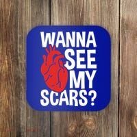 Pre Heart Transplant And After Open Heart Surgery Cool Gift Coaster thumb 0