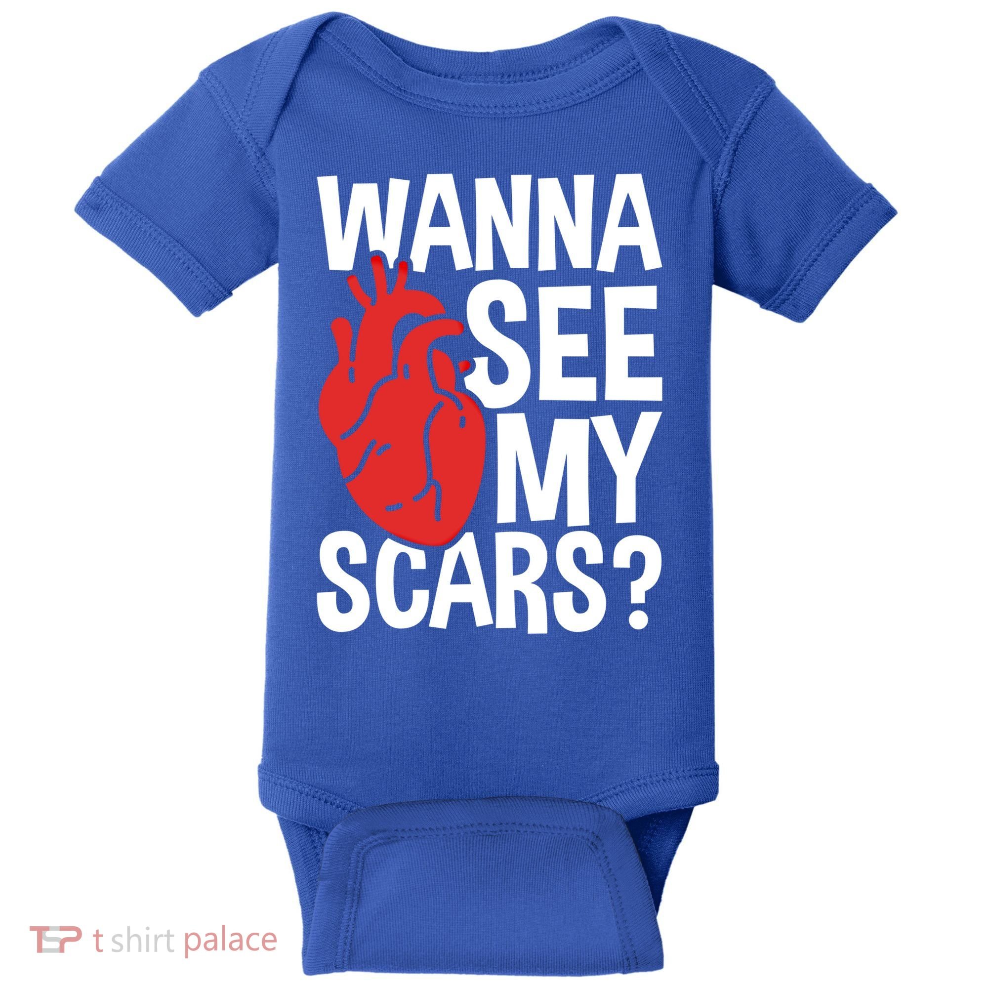 Pre Heart Transplant And After Open Heart Surgery Cool Gift Baby Bodysuit