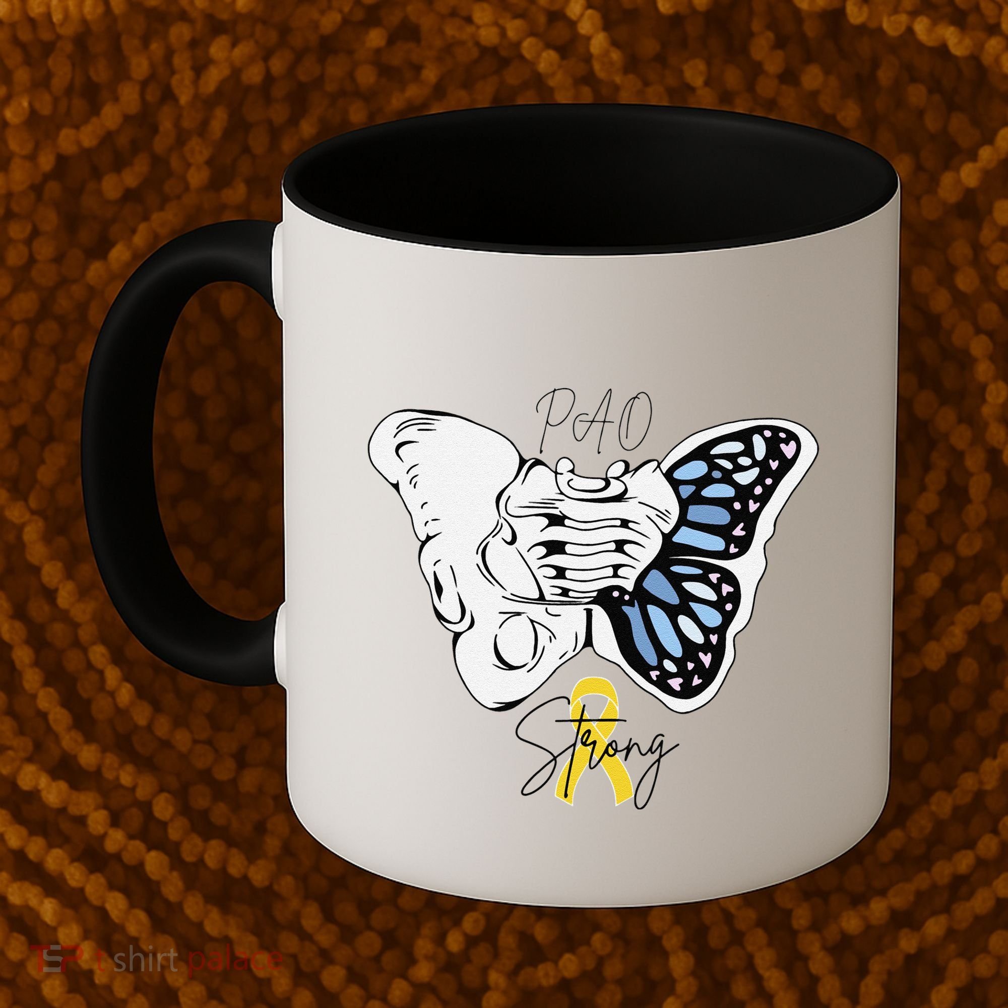 Pao Surgery Strong Hip Surgery Awareness Coffee Mug