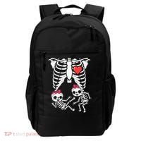 Skeleton Pregnancy Twins XRay Pregnant Halloween Backpack thumb 0